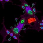 mouse-adapted-omicron-ba.1-infection-causes-persistent-lung-inflammation-and-fibrosis