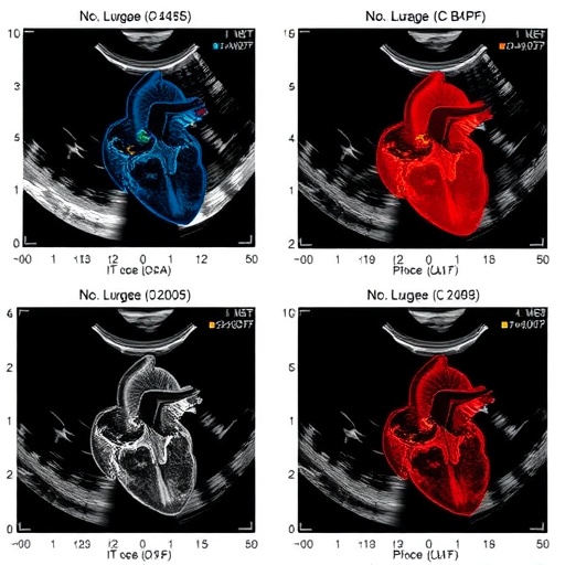 early-nt-probnp-versus-echocardiographic-plase-score-for-predicting-pda-surgery