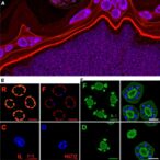 il-1-signaling-strengthens-mucosal-defense-against-systemic-candida-albicans-infection
