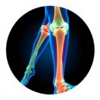 ai-and-genetic-insights-accelerate-discovery-of-new-osteoarthritis-treatments