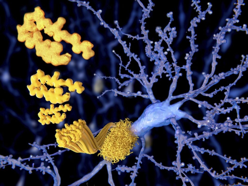 tau-protein-linked-to-mitochondrial-reverse-electron-transport-in-preclinical-models