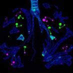 c/ebpγ-links-cancer-plasticity,-dna-repair,-and-therapy-resistance-in-lung-adenocarcinoma
