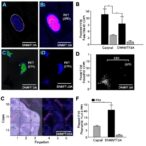 esm1-mediated-dnmt3a-suppresses-cervical-cancer-metastasis-via-id3-epigenetic-regulation