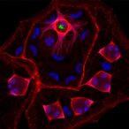 peripheral-myh11-expressing-nucleus-pulposus-cells-show-promise-against-disc-degeneration
