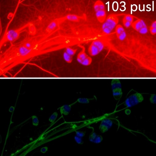 uva-induced-hyperploidization-causes-fibrosis-in-post-mitotic-fuchs-dystrophy-corneal-cells