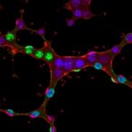 how-neuroblastoma-balances-replication-stress-and-genome-stability-across-chromosome-17q