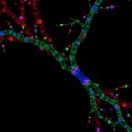 trk-and-igf1r-signaling-linked-to-delayed-ewing-sarcoma-growth