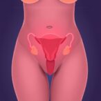 endometriosis-linked-to-46%-higher-type-2-diabetes-risk-in-women