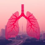 blood-metabolomic-signatures-link-air-pollution-to-lung-cancer-in-prevention-studies