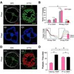 dgat1-controls-macrophage-pyroptosis-during-klebsiella-pneumoniae-infection
