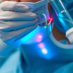dc-microcurrent-stimulation-significantly-reduces-postsurgical-scar-depth,-study-finds