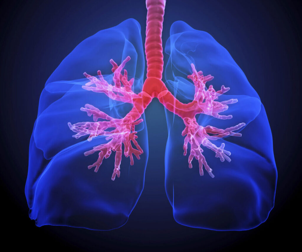 steroid-curbs-chronic-lung-inflammation-without-weakening-immune-defenses