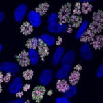 parasite-specific-protein-helps-toxoplasma-adapt-to-crowded-conditions