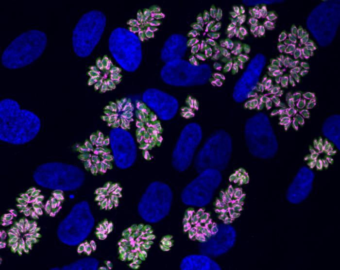 parasite-specific-protein-helps-toxoplasma-adapt-to-crowded-conditions