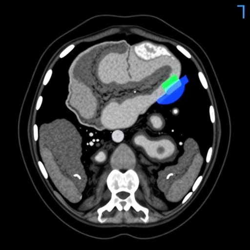 ai-foundation-model-stratifies-and-triages-acute-abdominal-diagnoses-using-noncontrast-ct