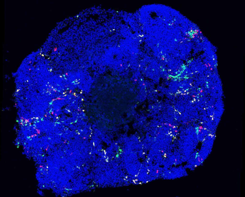 cortical-organoids-reveal-radial-glial-progenitor-lineage-dynamics