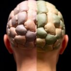natural-or-synthetic-grafts:-which-is-better-for-cranial-duraplasty?