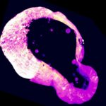 newly-discovered-role-for-polyamines-could-point-to-potential-anticancer-strategies