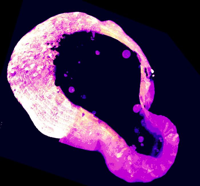newly-discovered-role-for-polyamines-could-point-to-potential-anticancer-strategies