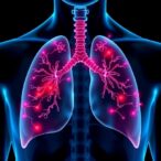 inflammatory-enzyme-targeting-drug-may-help-prevent-lung-cancer