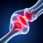 muscle-plays-a-crucial-role-alongside-bone-in-fracture-repair