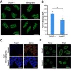 dusp4-boosts-antitumor-cd8+-t-cells,-car-t-efficacy-in-colorectal-cancer-mice