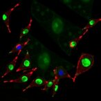 schisandrin-lignans-stabilize-gpx4-to-suppress-ferroptosis-in-drug-induced-liver-injury