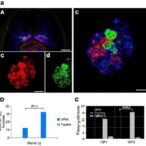vrk2-drives-gemcitabine-resistance-in-pancreatic-cancer-through-tpi1-mediated-aerobic-glycolysis