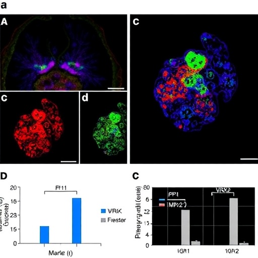 vrk2-drives-gemcitabine-resistance-in-pancreatic-cancer-through-tpi1-mediated-aerobic-glycolysis