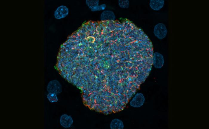 malaria-mosquito-bites-turned-into-immune-boosters-in-new-chemovaccination-strategy