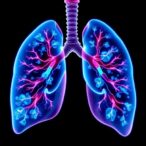 integrated-data-and-machine-learning-transform-lung-cancer-diagnosis-and-treatment
