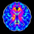 dual-frequency-photoacoustic-imaging-maps-vessels-and-oxygenation-across-the-mouse-brain