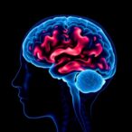 cortical-thinning-precedes-high-amyloid-levels-by-at-least-seven-years