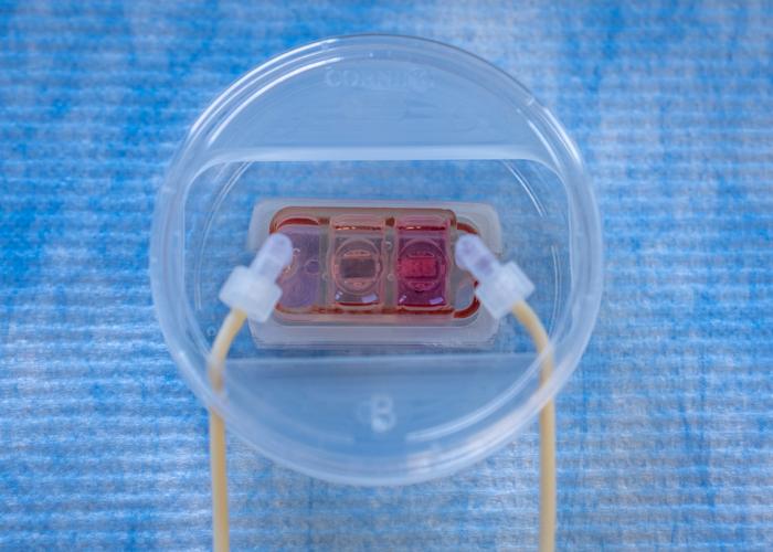 human-multi-organ-chip-offers-new-insight-into-cancer-metastasis