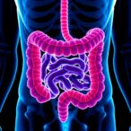how-aggressive-colon-cancer-tumors-evade-the-immune-system