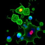 cd39+cd103+cd8+-t-cells-boost-neoadjuvant-chemoimmunotherapy-in-head-and-neck-cancer