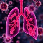lung-tumor-bacteria-may-stimulate-the-immune-system-against-cancer