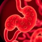 mayo-clinic-study-estimates-cancer-risk-from-pancreatic-cysts,-improving-early-detection