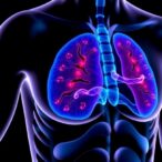 isoleucine-and-valine-fuel-prostate-cancer-progression-by-altering-cholesterol-metabolism