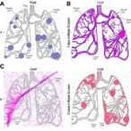 clonal-follicular-cd4+-t-cells-adapt-across-lymph-nodes-and-lung-tumors