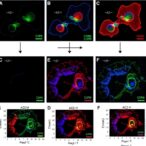 study-reveals-clonal-diversity-among-ccr8-positive-regulatory-t-cells-in-human-cancer