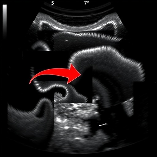 deep-learning-precisely-grades-schistosoma-japonicum-liver-fibrosis-using-ultrasound-images