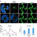 alanine-trna-fragments-and-meg3-variant-vary-with-tissues-and-parkinson’s-severity