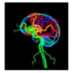 proteomics-links-environmental-and-genetic-parkinson’s-models-to-purine-metabolism