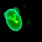 hypercontractile-embryos-from-older-female-mice-experience-implantation-failure
