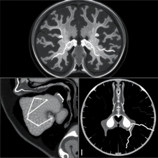 comprehensive-review-of-benchmark-datasets-for-deep-learning-in-medical-image-segmentation