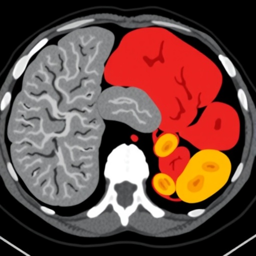 study-evaluates-foundation-models-for-organ-level-classification-using-ct-scans