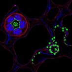 uggt1-drives-liver-cancer-angiogenesis-by-glycosylating-lgals3bp-through-notch-signaling