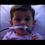 video-bronchoscopy-assisted-intubation-shows-promise-in-children-with-difficult-airways