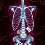 postmortem-metabolomics-reveals-agonal-death-processes-in-opioid-overdoses-and-hangings